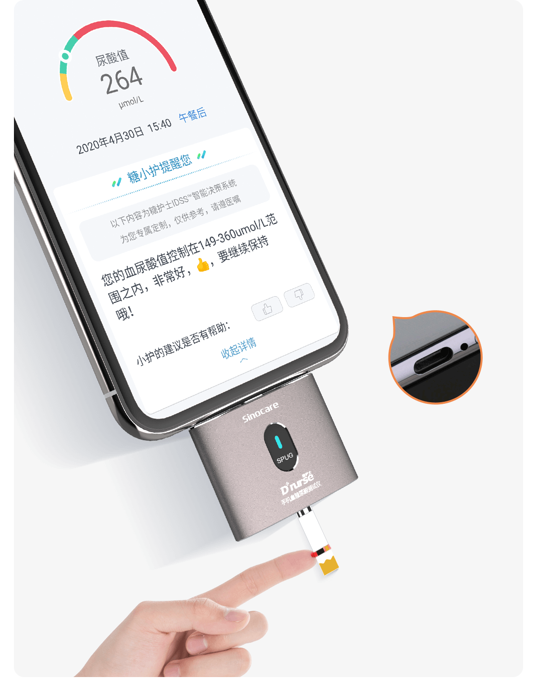 糖护士®️SPUG血糖尿酸测试仪